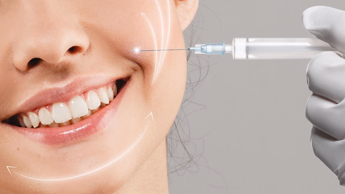 Ai phù hợp — Tiêm botox rãnh cười dành cho trường hợp nào và khi nào không nên?