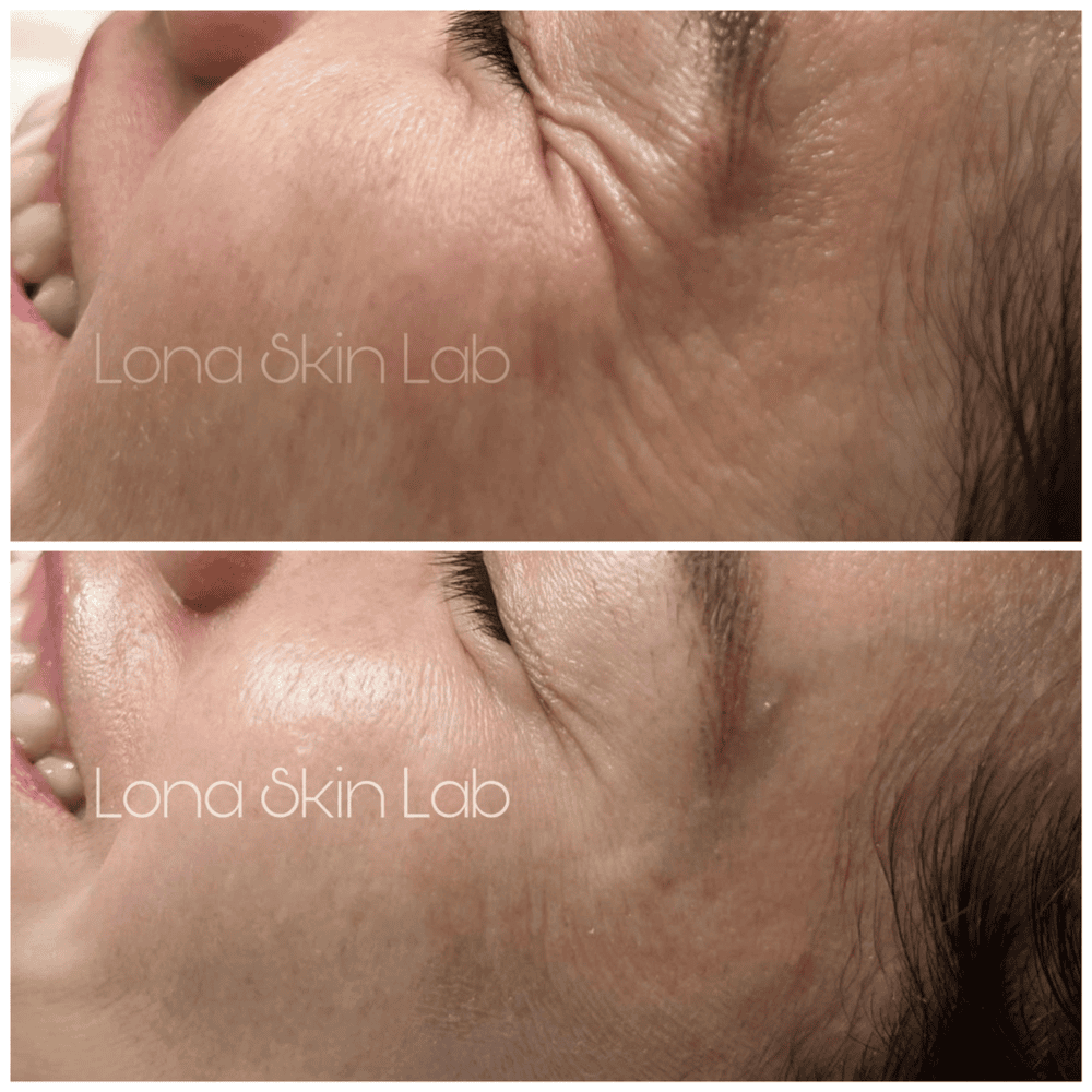 Lợi ích, rủi ro và cách chọn cơ sở thực hiện an toàn