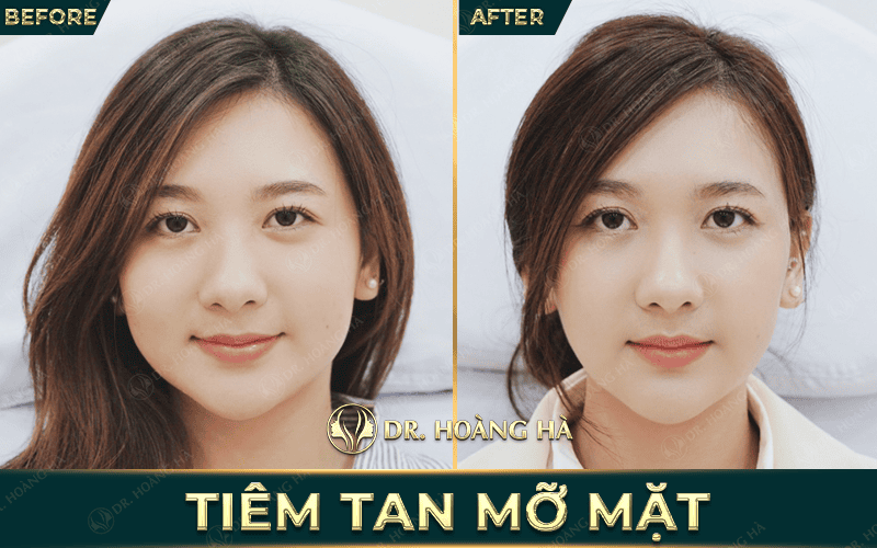 Khám và đánh giá trước tiêm