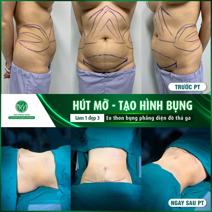 Những lưu ý về liều và kỹ thuật