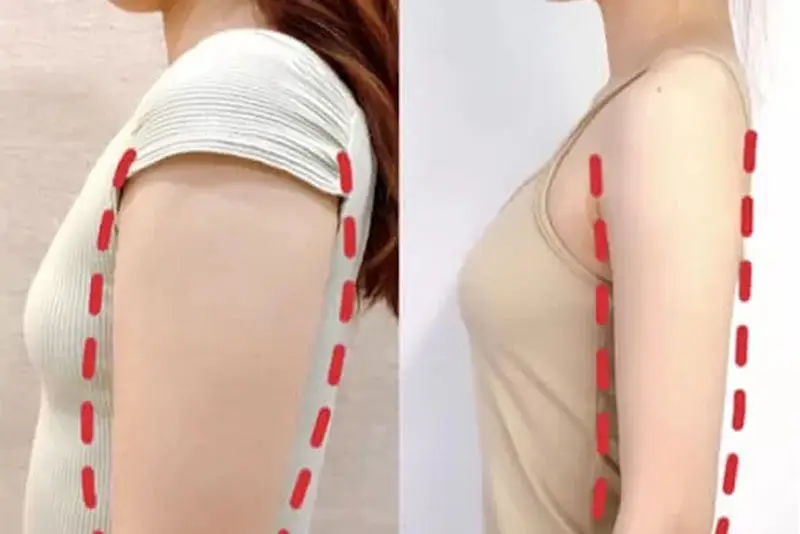 Tác dụng phụ và cách xử trí khi có biến chứng