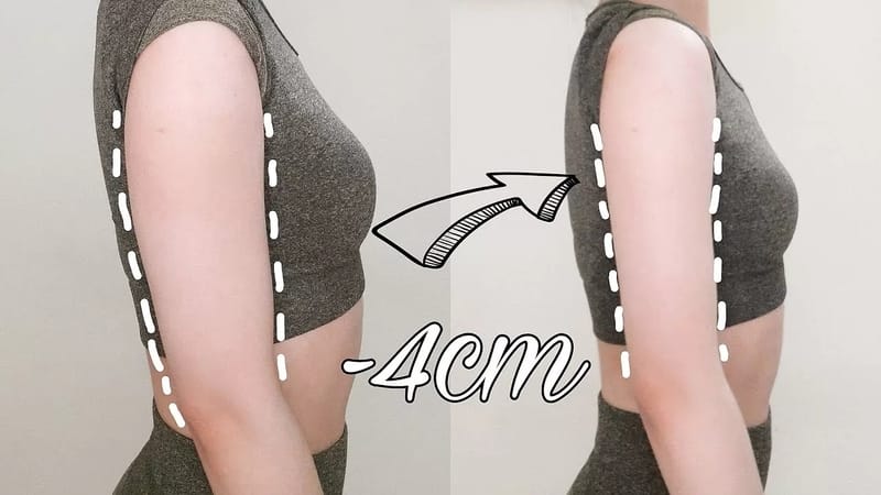 Ai phù hợp và ai không nên tiêm Botox để thon gọn bắp tay?