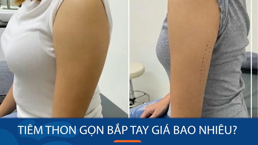 So sánh ngắn các phương pháp phổ biến