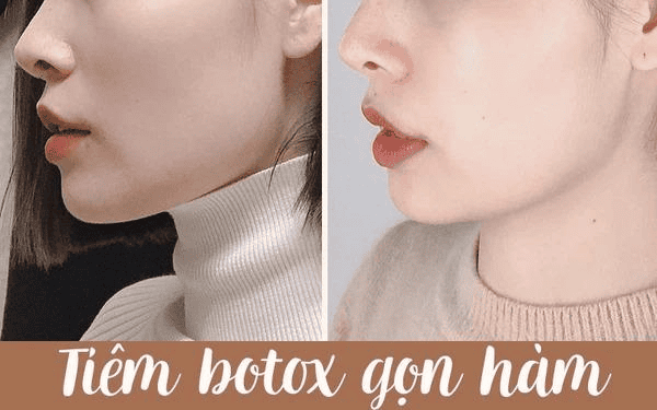 Thuốc, thực phẩm và bệnh lý cần lưu ý trước/sau tiêm