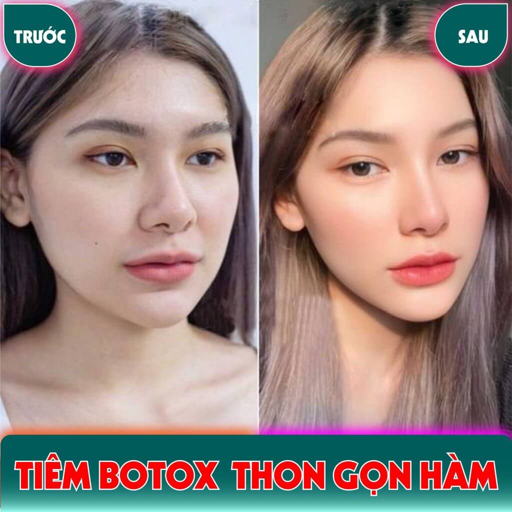Làm sao chọn liều và kỹ thuật phù hợp — có công thức chung không?