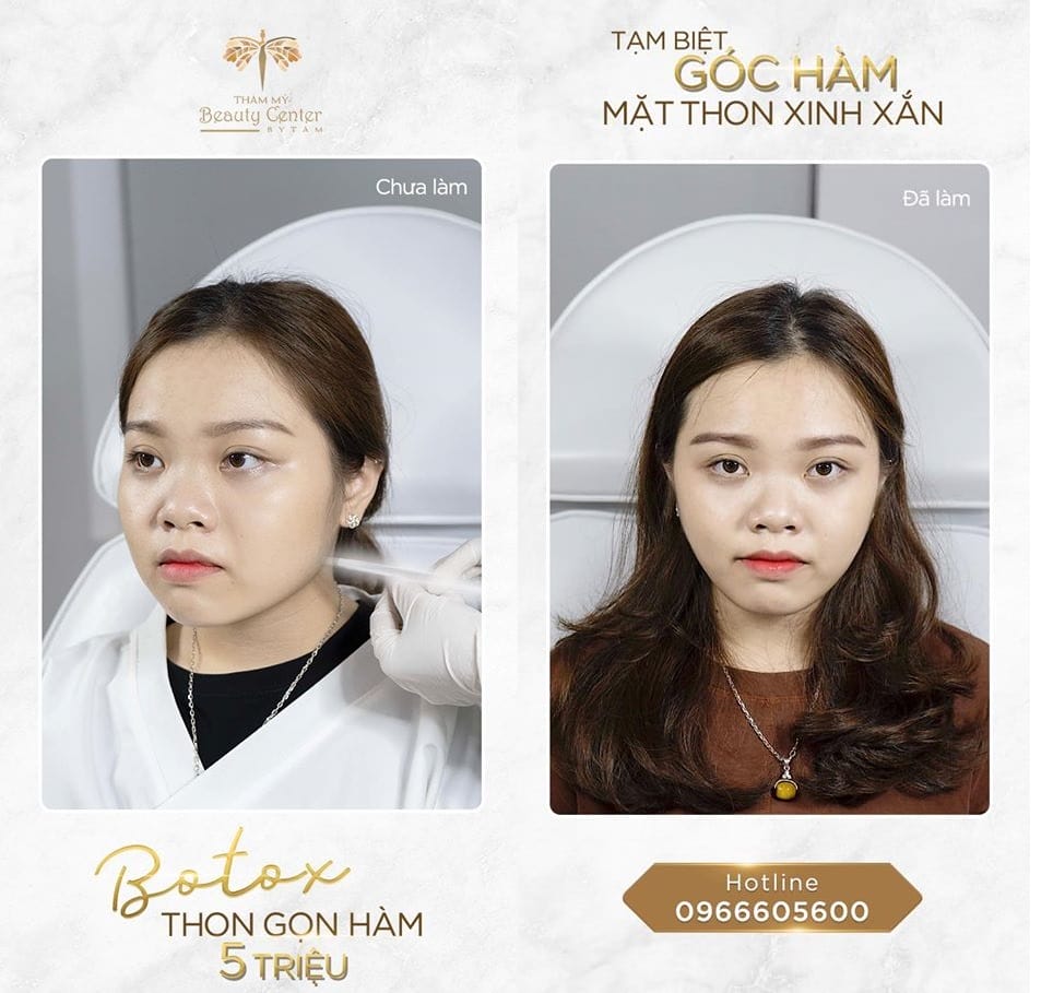 Những câu hỏi thường gặp bạn sẽ tự hỏi trước khi quyết định