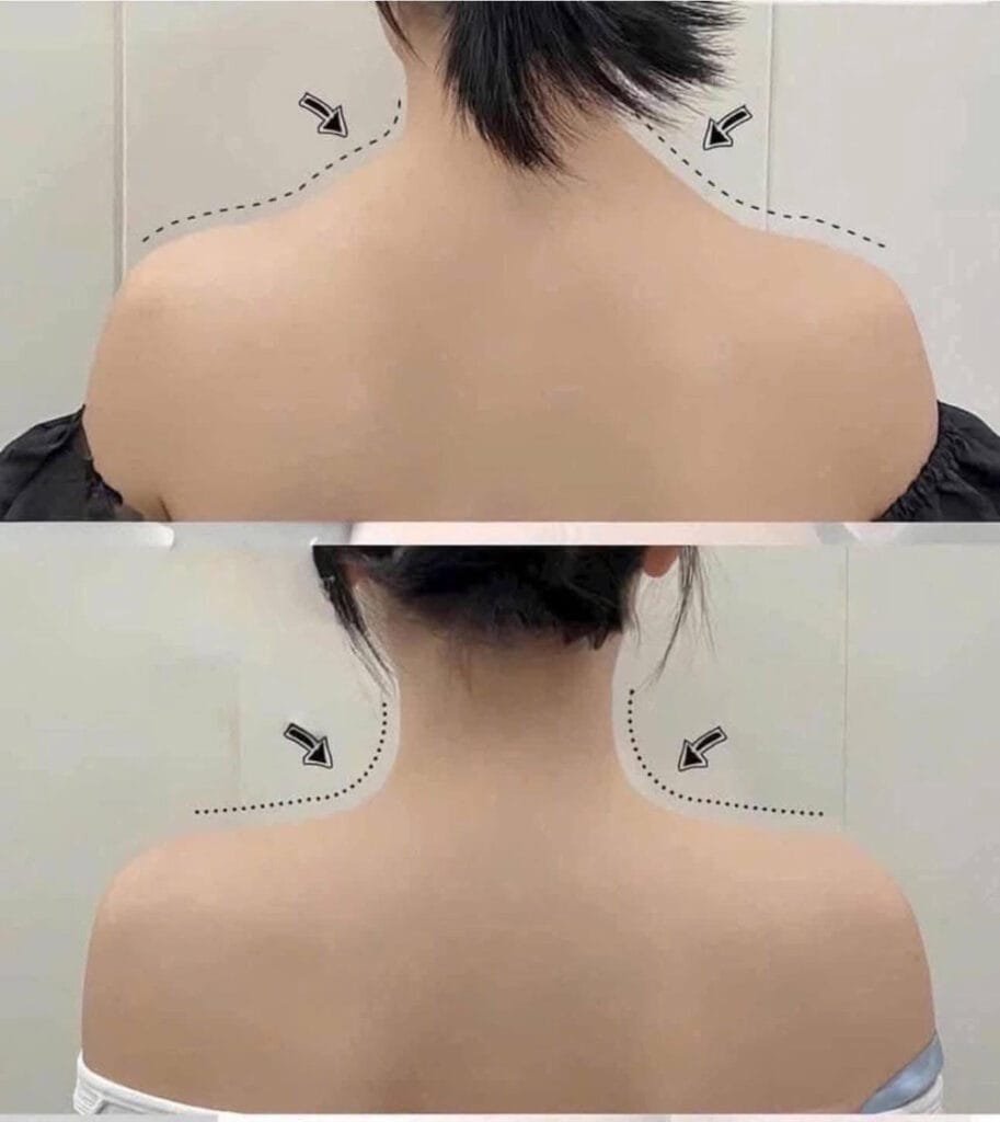 Làm sao chọn nơi tiêm an toàn để giảm rủi ro và đạt kết quả hài hoà?