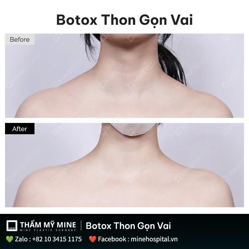 Làm thế nào để bắt đầu nếu đang cân nhắc liệu trình này?