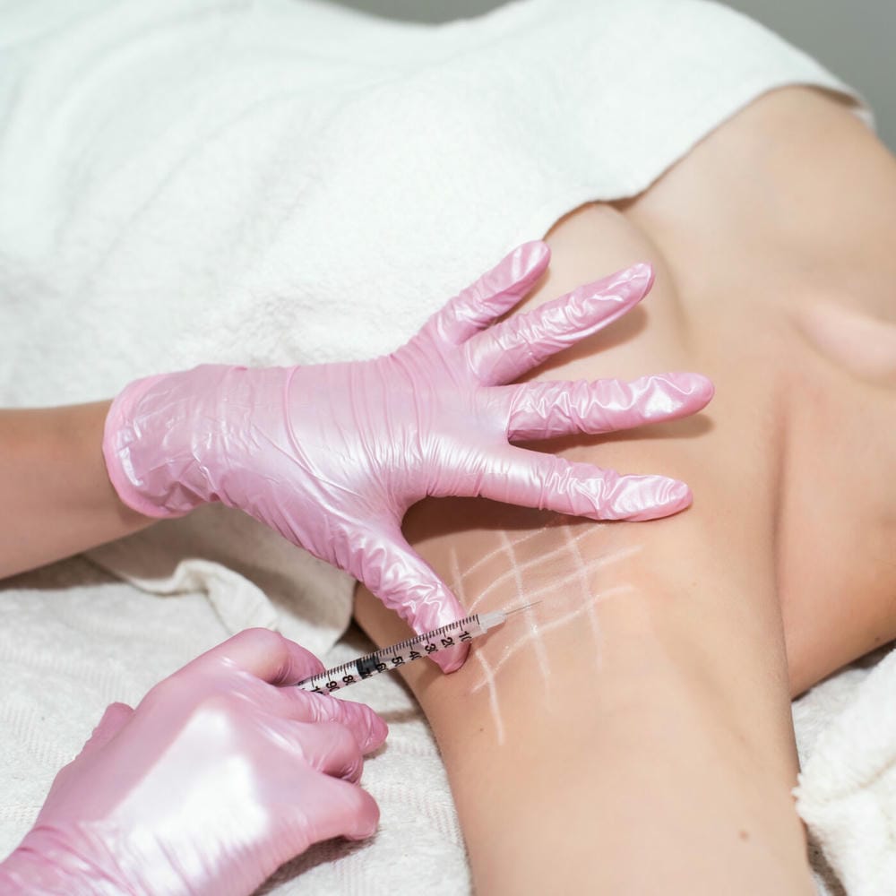 Quy trình tiêm botox trị mồ hôi nách diễn ra như thế nào — có đau và cần lưu ý gì?