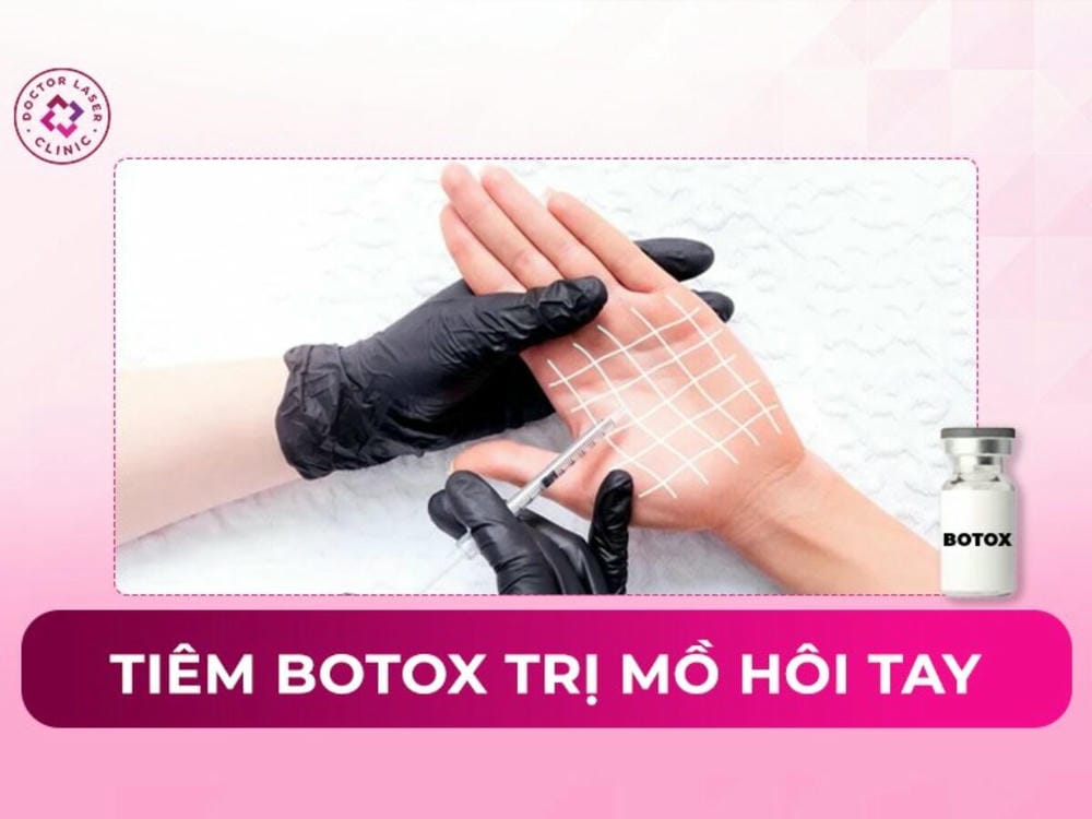 Ai phù hợp hoặc không phù hợp với tiêm Botox trị mồ hôi tay — rủi ro thường gặp?