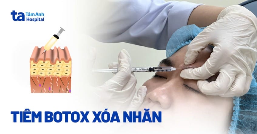 Những câu hỏi nên hỏi bác sĩ trước khi tiêm — làm sao để giảm rủi ro và đạt kết quả tự nhiên?