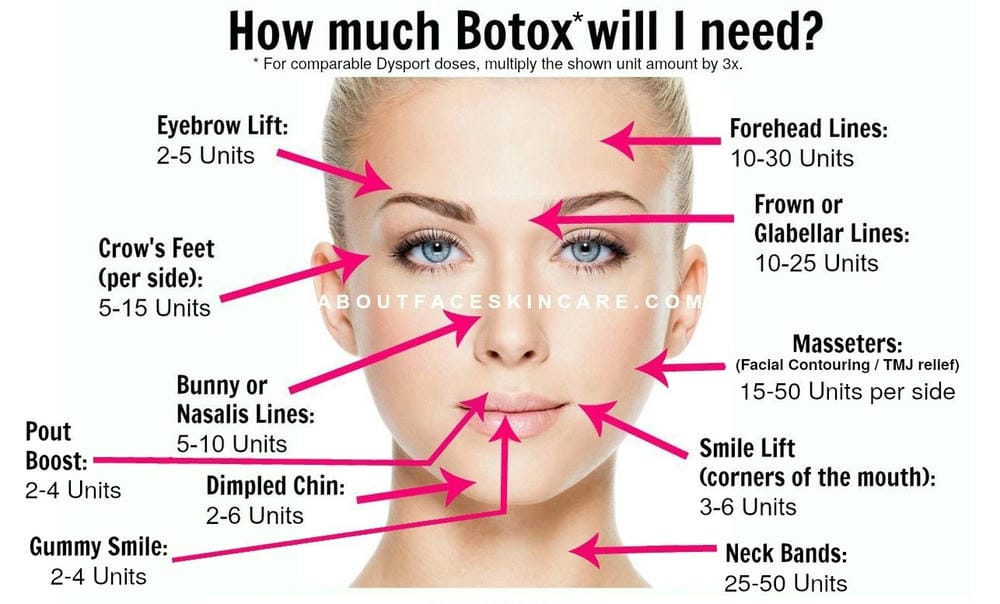 Tiêm botox vào cơ an toàn không và những rủi ro thường gặp là gì?