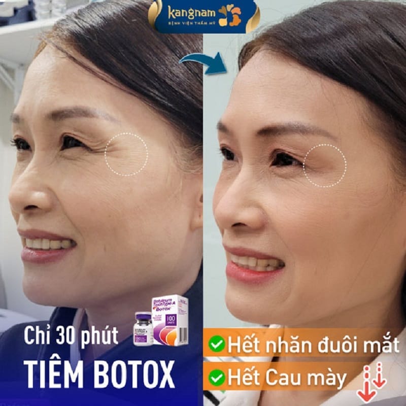 Những câu hỏi thường gặp mà khách hàng thường lo lắng
