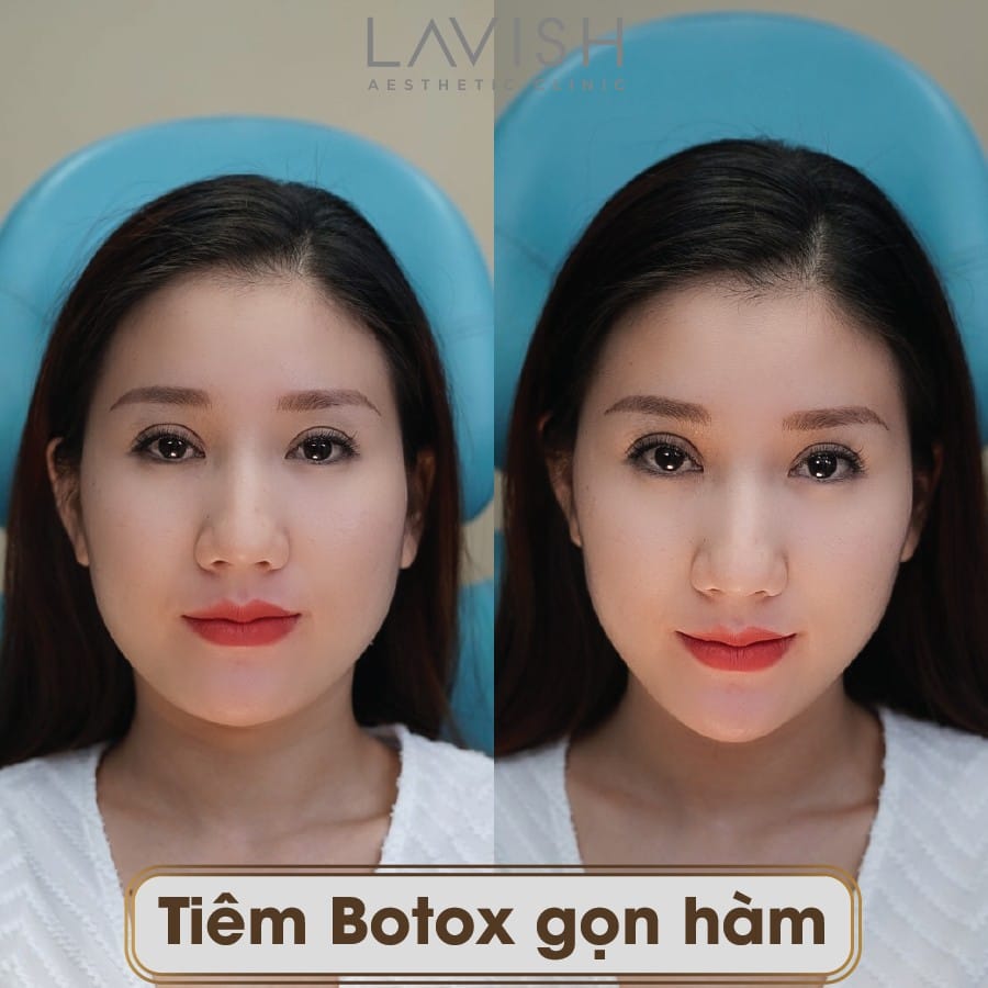 Những câu hỏi khách hàng thường lo lắng — trả lời ngắn gọn