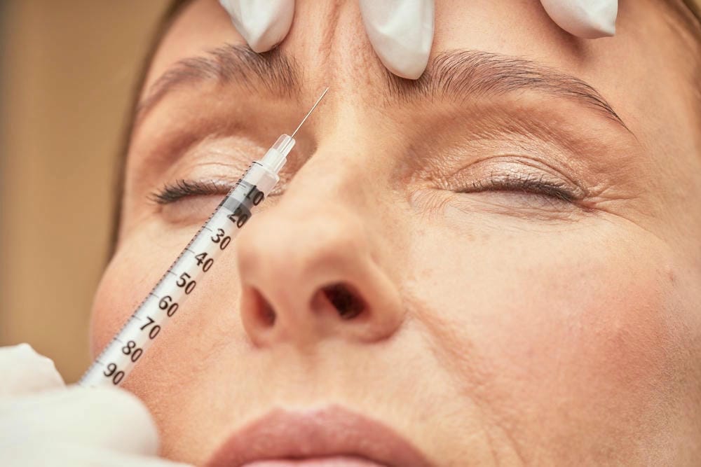 Chọn sản phẩm nào để xóa nếp nhăn — filler HA Vivacy, Opera, Aileene và cách ưu tiên ra sao?