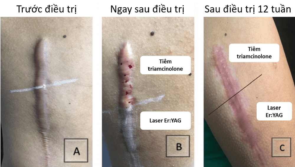 Liều, tần suất và khi nào cần dừng — có quy chuẩn rõ ràng không?