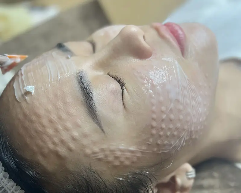 Sau khi tiêm cần chăm sóc thế nào để đạt hiệu quả và giảm rủi ro?