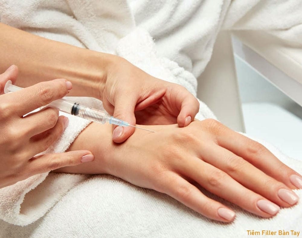 Quy trình tiêm filler bàn tay an toàn gồm những bước nào — và kỹ thuật tiêm ra sao?