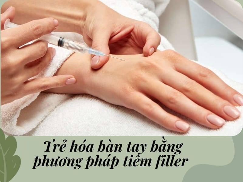 Những câu hỏi khách hàng thường thắc mắc