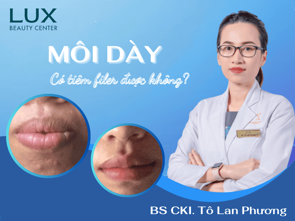 Kỹ thuật nào phù hợp để tiêm môi dày: kim hay kỹ thuật cannula, và có nên theo MD Codes?