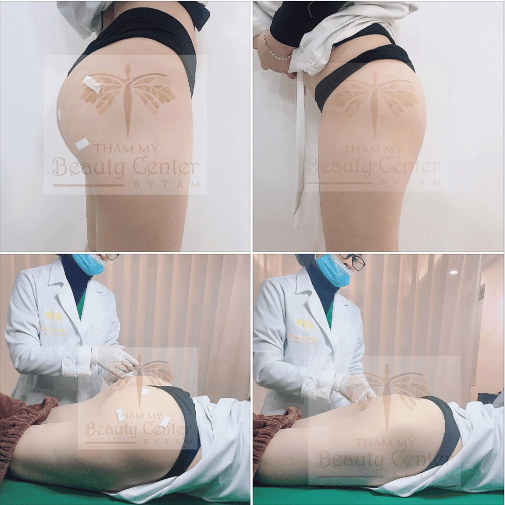 Những câu hỏi thường gặp khách hàng hay băn khoăn