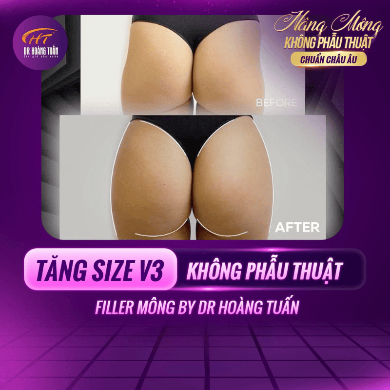 Kết quả kéo dài được bao lâu và có cần duy trì?