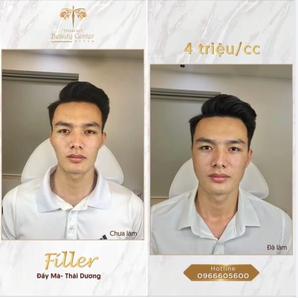 Về lựa chọn sản phẩm