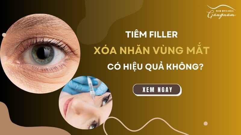 Loại filler nào phù hợp nhất cho vùng mắt và khuyến nghị tại Lona Skin Lab?