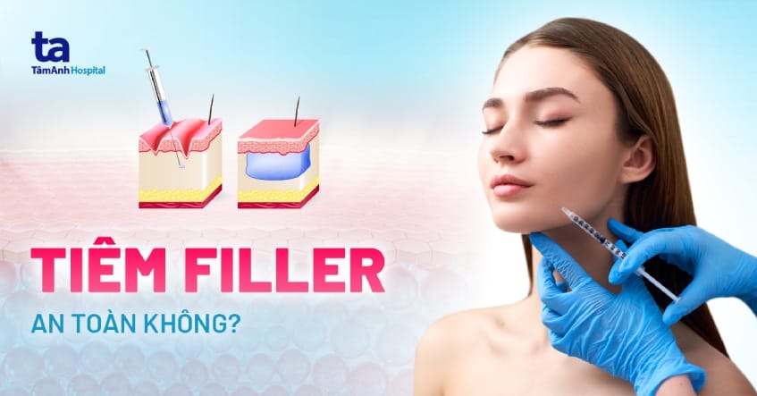 Gợi ý thương hiệu đã được sử dụng ở thị trường và ưu tiên theo trải nghiệm lâm sàng