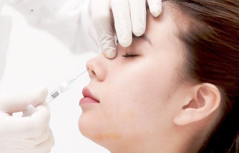 Quy trình tiêm filler an toàn: cần chuẩn bị và thực hiện những bước nào?