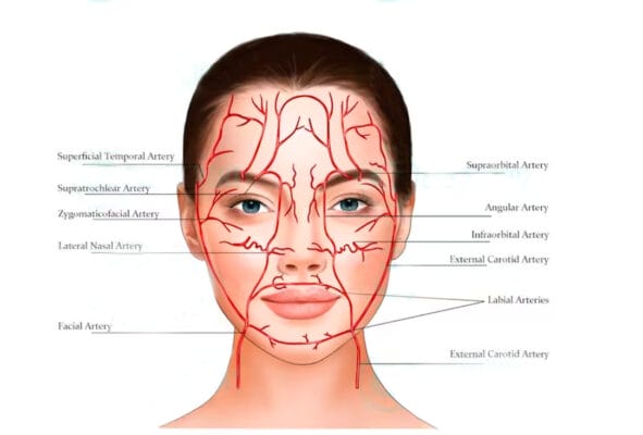 Nếu bị tắc mạch do HA thì có thể xử trí không và bằng cách nào?