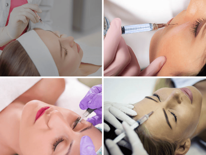 Làm sao để giảm nguy cơ? Checklist chọn cơ sở tiêm filler an toàn