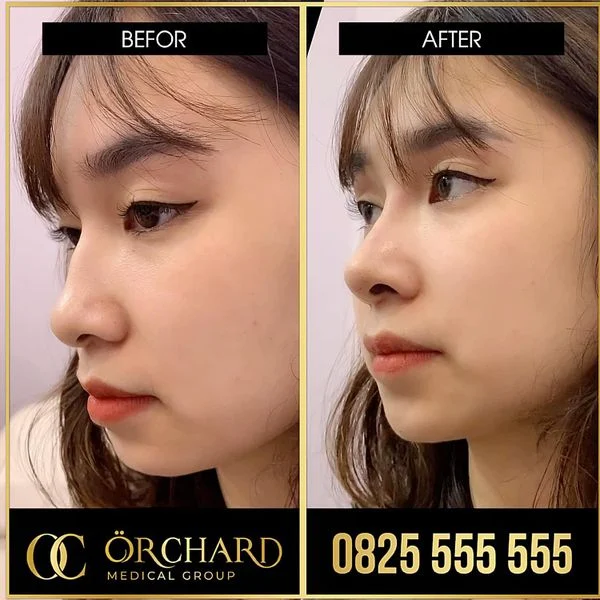 Chăm sóc sau tiêm và những lưu ý