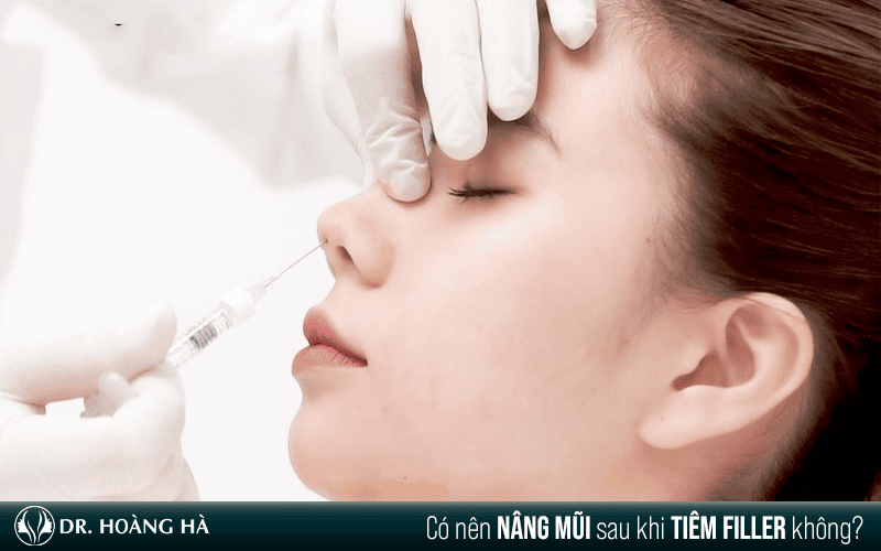 Những yếu tố làm tăng rủi ro