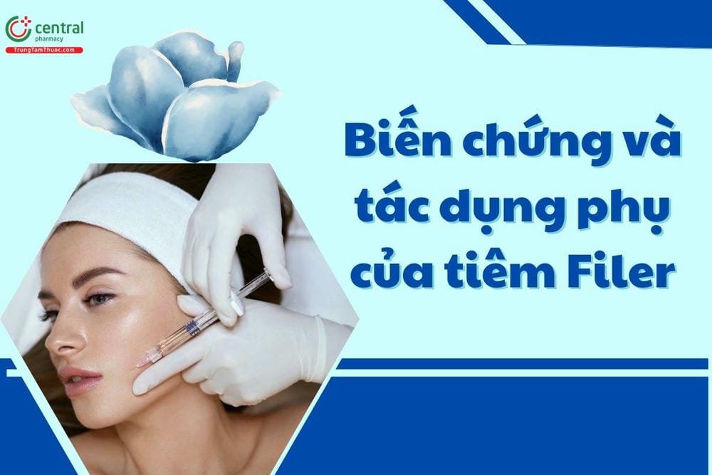 Tại sao có người bị mù sau tiêm filler — nguy cơ này xảy ra như thế nào?