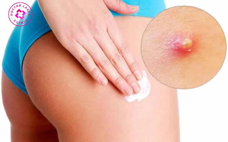 Quy trình trước và sau khi tiêm cho người hay tập thể dục — checklist cần chia sẻ với bác sĩ