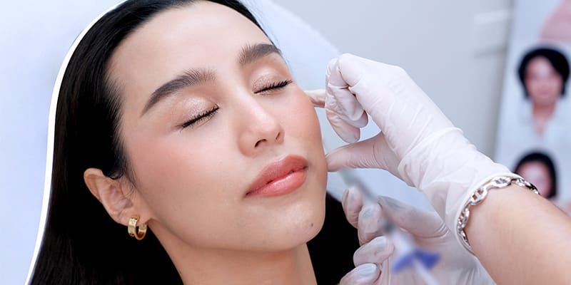 MD Codes và vai trò trong tiêm filler căng da — có nên áp dụng?