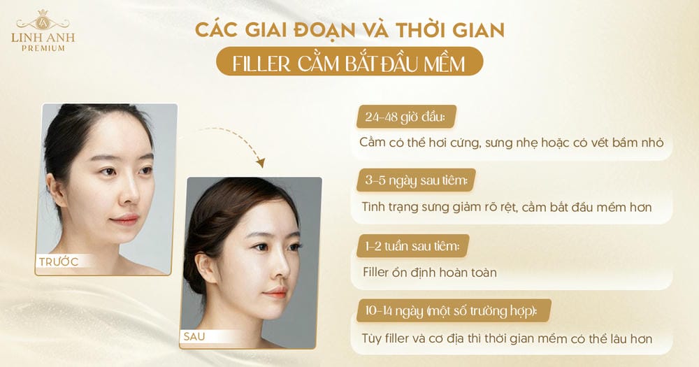 Những yếu tố làm tăng nguy cơ cằm bị cứng hoặc nốt