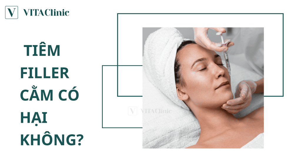 Lời khuyên thực tế trước khi đặt lịch tiêm filler cằm