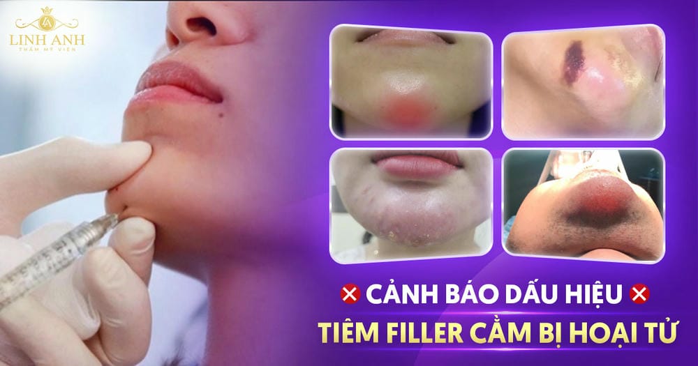 Làm sao giảm thiểu rủi ro khi quyết định tiêm filler cằm — quy trình an toàn và chuẩn bị hyaluronidase hòa tan filler