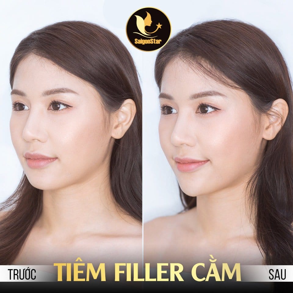 Quy trình tiêm cơ bản (một phiên chuẩn)
