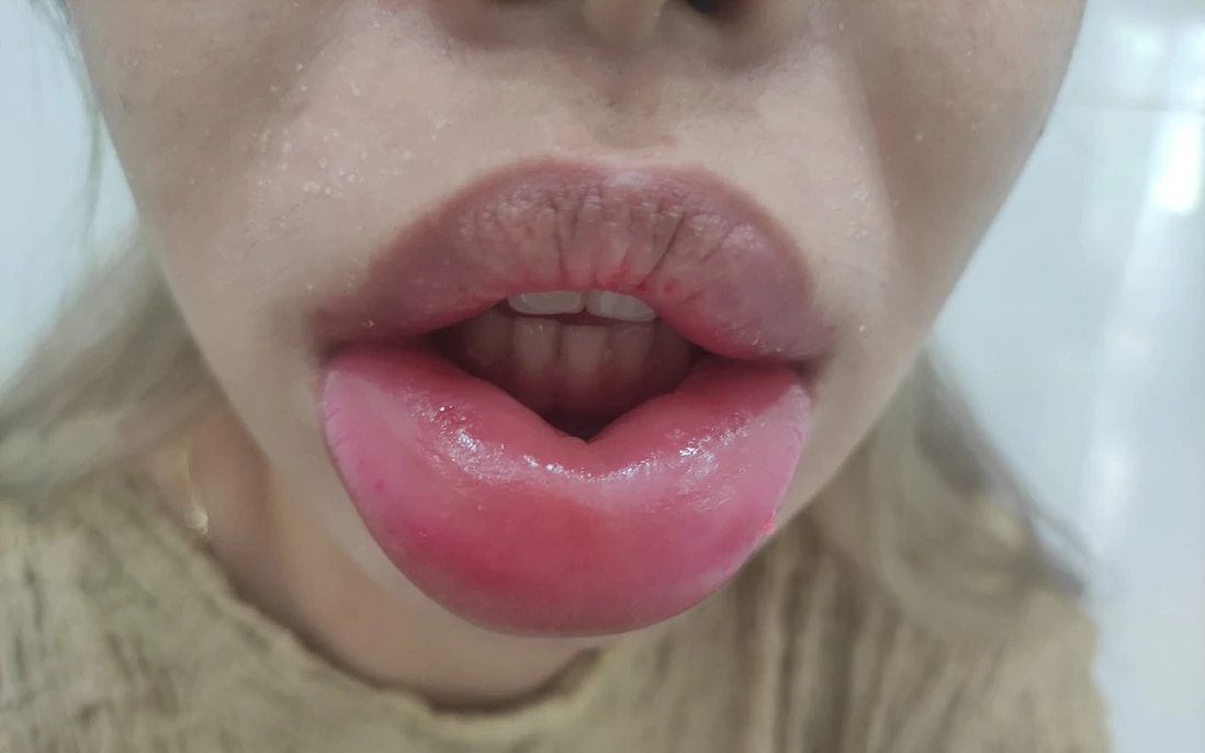 Muốn bắt đầu: những câu hỏi nên hỏi khi đặt lịch tư vấn tại clinic