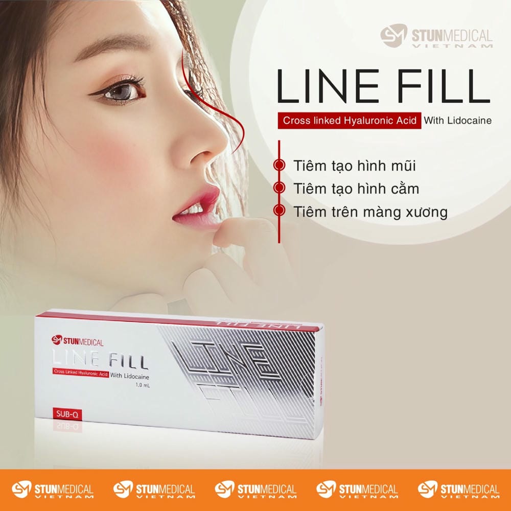 Lời nhắn dành cho khách hàng đang phân vân về tiêm filler cứng