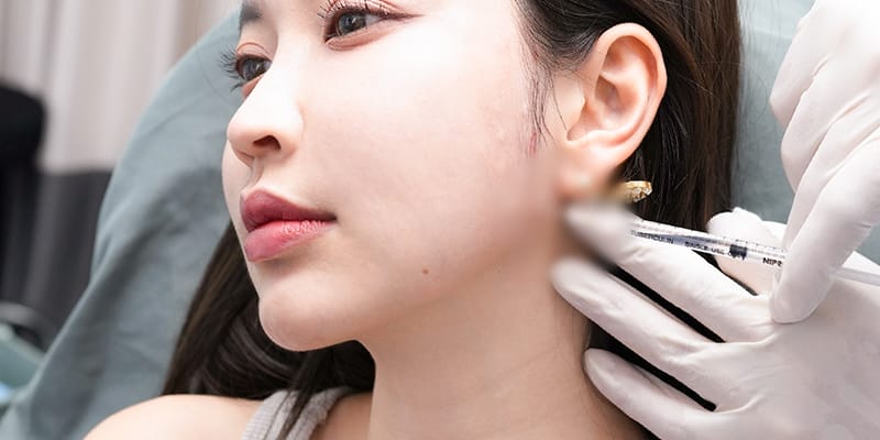 So sánh: Tiêm filler gọn mặt khác gì so với tiêm botox masseter hoặc phẫu thuật giảm mỡ/hút mỡ?