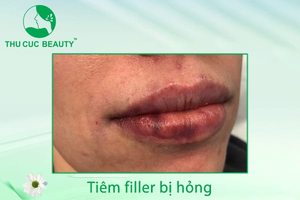 Lựa chọn phương án sửa chữa thẩm mỹ sau khi biến chứng ổn định — có thể phục hồi được như trước?