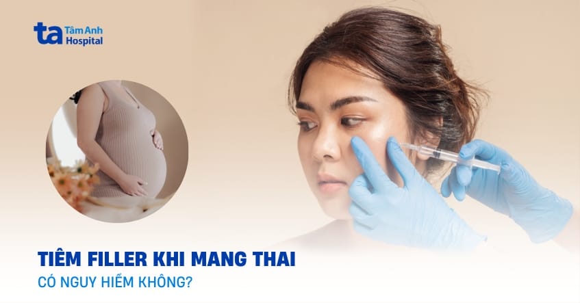 Tiêm filler khi mang thai có an toàn không?