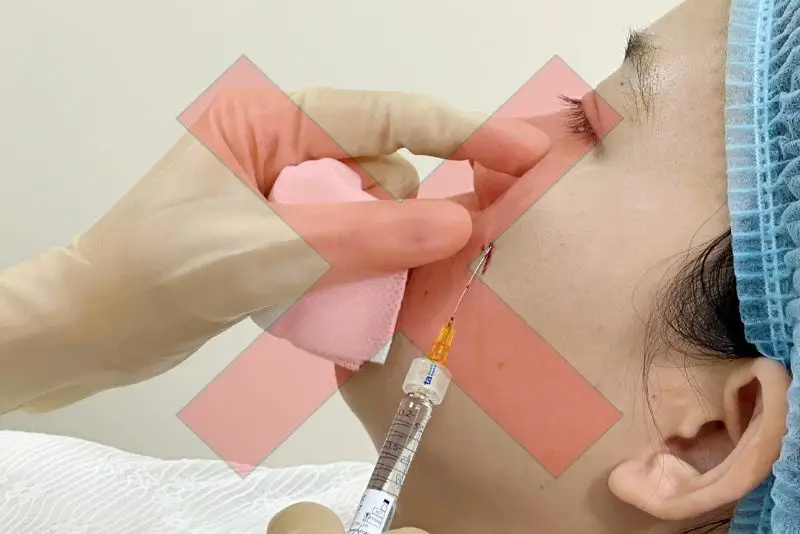 Nếu đã tiêm filler trước khi biết mình có thai, cần làm gì?