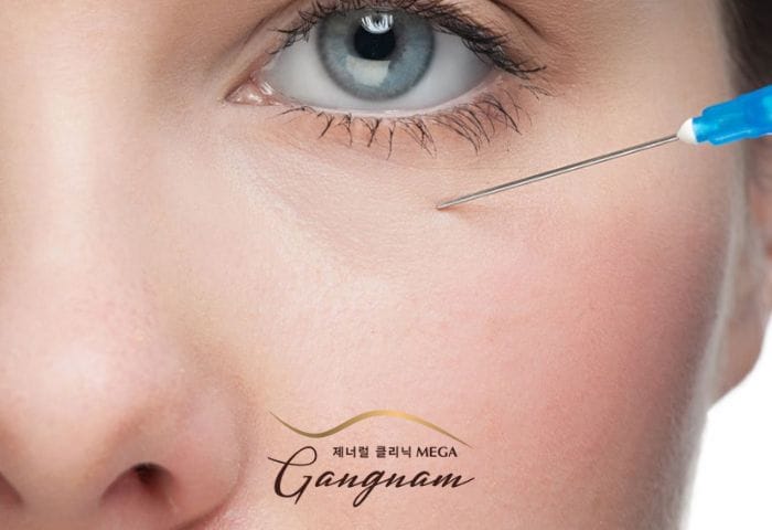 Quy trình tiêm filler khoé mắt an toàn ở phòng khám đạt chuẩn như thế nào?