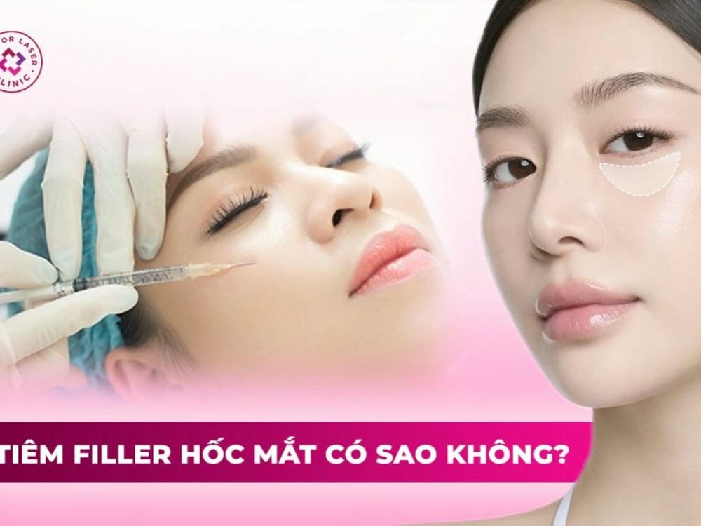 So sánh phương pháp: tiêm filler vs ghép mỡ vs phẫu thuật mí dưới
