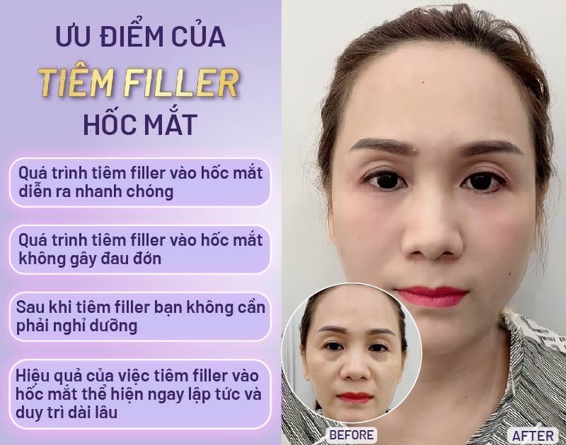 Chi phí có thể giảm bằng cách nào mà vẫn an toàn?